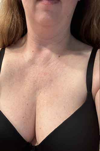 Anja, 35 Jahre